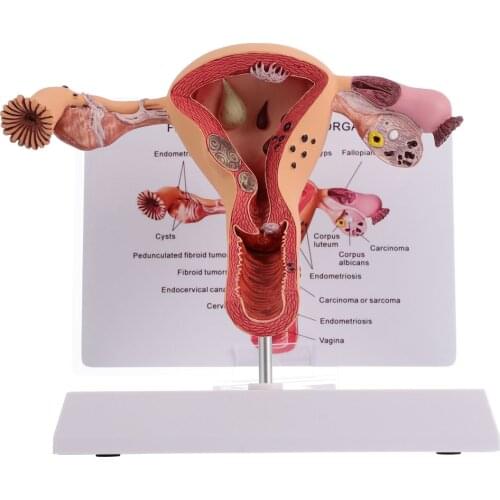 1Pc Female Reproductive Organs Anatomy Model Uterus Model for