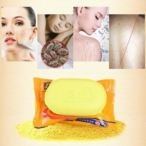 Shanghai Sulfur Soap Anti-mites Anti-acne Body Cleansing Soap Skin Treatment Acne Psoriasis Seborrhea Eczema Anti Fungus