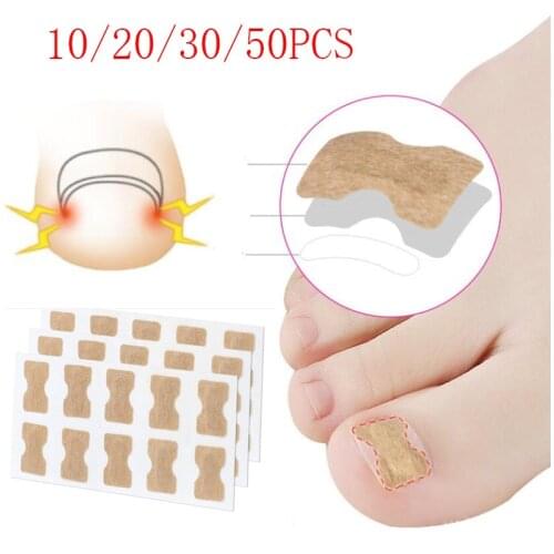 Ingrown Toenail Corrector Stickers Paronychia Treatment Pedicure Toe Nail Care Corrector Patch Correction Stickers 10-50Pcs