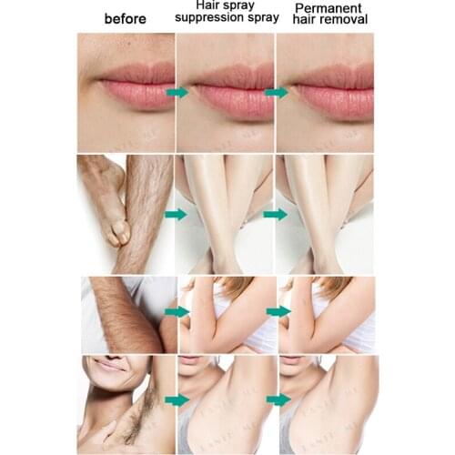 Hair Growth Inhibitor Spray Bikini Face Legs Body Armpit Painless Hair Remover can CSV