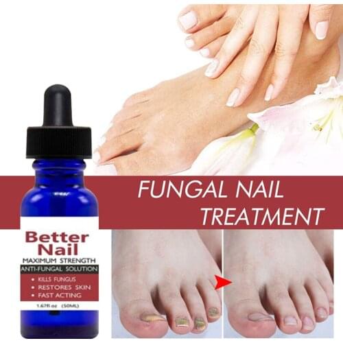 50ml Nail Repair Liquid Anti Fungus Toe Serum Remove Nail Onychomycosis Essence Nail Treatment Liquid Hand Foot Care Nail Art